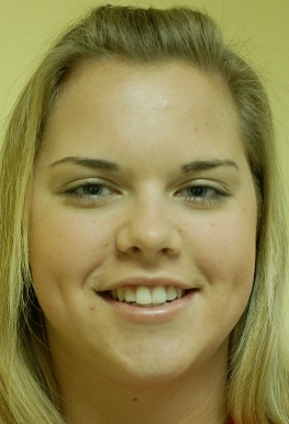 Allison Hinton